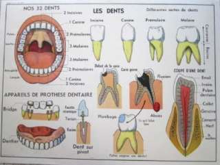 French Vintage School Poster Anatomy Dental Teeth Mouth  